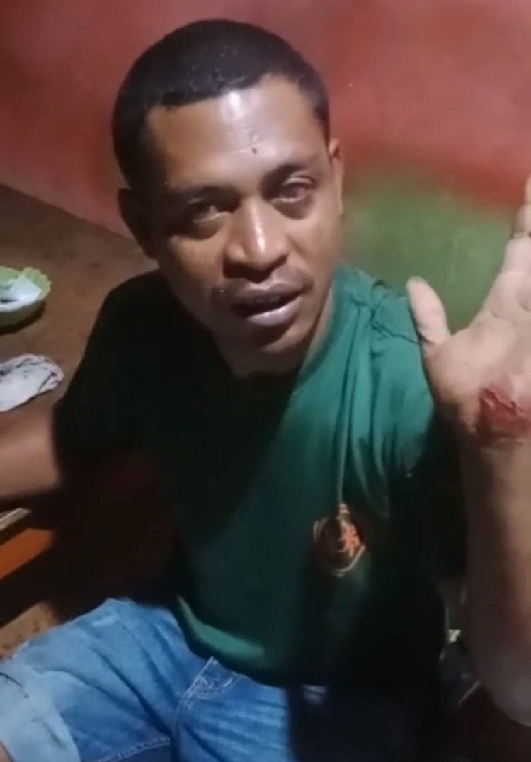 Damianus Deufester Wae, korban begal yang selamat menunjukan telapak tangannya yang luka saat lompat dari motor, Kamis 7 Desember 2023. (Foto : Ist./Koranpapua.id)