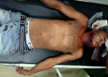 Korban Kritis di RSUD, Opsnal Reskrim Polsek Miru Ringkus Pelaku Penganiayaan   