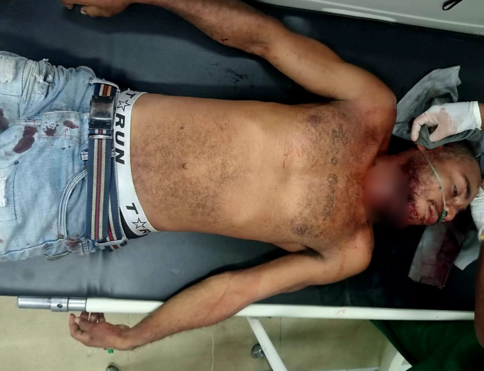 Korban Kritis di RSUD, Opsnal Reskrim Polsek Miru Ringkus Pelaku Penganiayaan