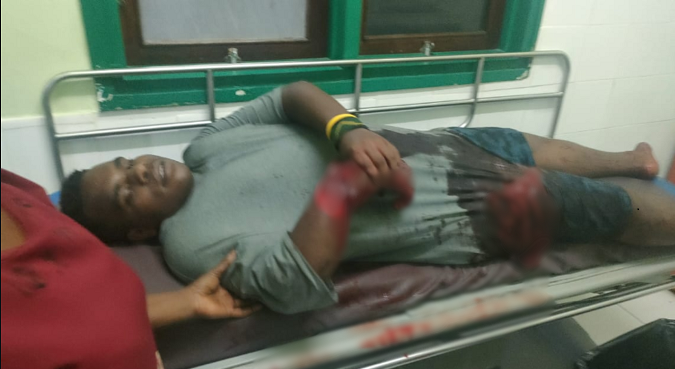 Warga yang Dibacok Berstatus Pelajar, Kasat Reskrim: Tidak Ada Kaitan dengan Pemilu