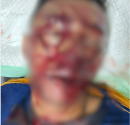 Iknasius Yaminus, Honorer Dinas Pendidikan Mimika Dianiaya OTK