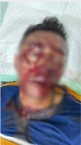 Iknasius Yaminus, Honorer Dinas Pendidikan Mimika Dianiaya OTK