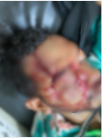 Belum Diketahui Penyebabnya, Seorang Pria dengan Luka Cukup Parah Dirawat di RSUD Mimika