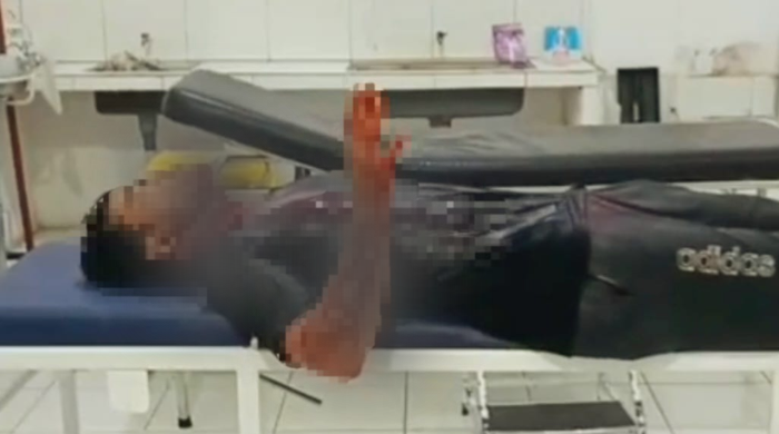 Bripka Marsidon Terluka Setelah Empat Peluru yang Ditembak OTK Menembus Kaca Mobil Polisi