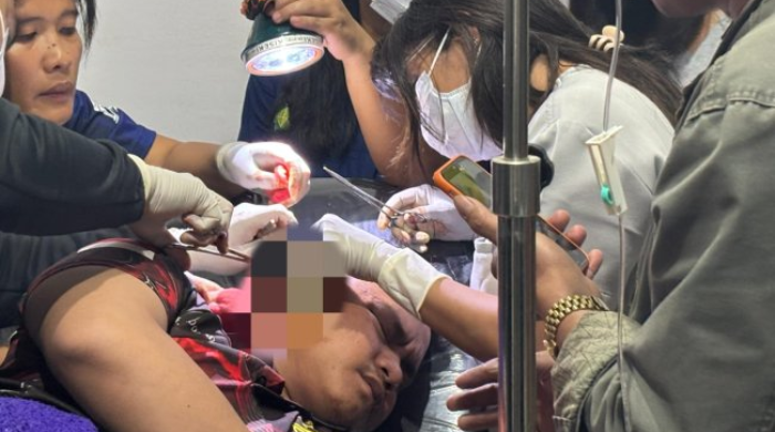 Bripda Ricardo Luka Serius Dianiaya OTK, Dugaan Awal Pelaku Anggota KKB