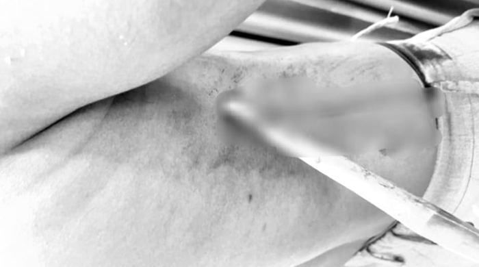 Personel Brimob Terkena Panah di Kwamki Narama, Empat Pelaku Ditangkap