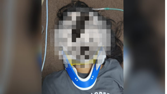 Korban Laka Ganda di Jalan Samratulangi Jalani Operasi Intensif di RSUD Mimika, Identitasnya Terungkap