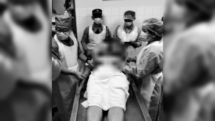 Kasus Penembakan di Areal Kerja Freeport: Berpura-Pura Meninggal, Simson Selamat dari Maut