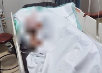 Cekcok Berujung Parang! Pria di Timika Sabet Tetangga, Korban Luka Parah di Kepala