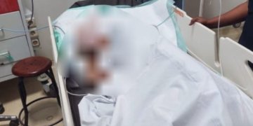 Cekcok Berujung Parang! Pria di Timika Sabet Tetangga, Korban Luka Parah di Kepala