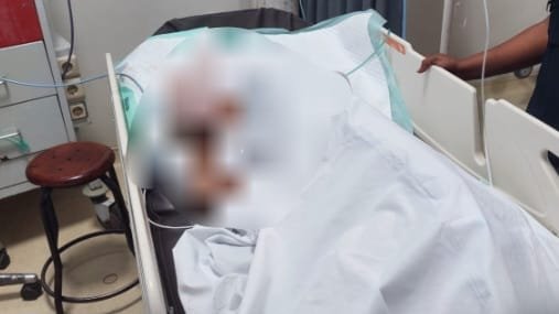 Cekcok Berujung Parang! Pria di Timika Sabet Tetangga, Korban Luka Parah di Kepala