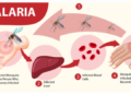 Malaria Tropika Papua: Ancaman Serius dan Upaya Eliminasi yang Berkelanjutan