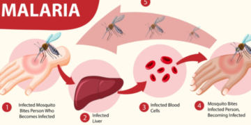 Malaria Tropika Papua: Ancaman Serius dan Upaya Eliminasi yang Berkelanjutan