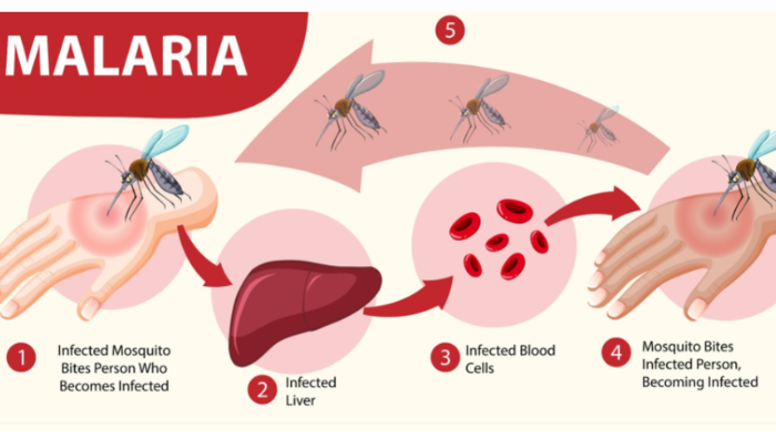 Malaria Tropika Papua: Ancaman Serius dan Upaya Eliminasi yang Berkelanjutan