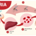 Malaria Tropika Papua: Ancaman Serius dan Upaya Eliminasi yang Berkelanjutan