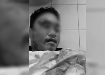 Polisi di Timika Lakukan Penyelidikan Misteri Kematian Pria di Bawah Truk