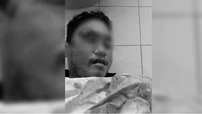 Polisi di Timika Lakukan Penyelidikan Misteri Kematian Pria di Bawah Truk