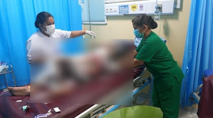 12 Hari Berjuang, Remaja Putri Akhirnya Meninggal Usai Diduga Dibakar Ibu Kandung