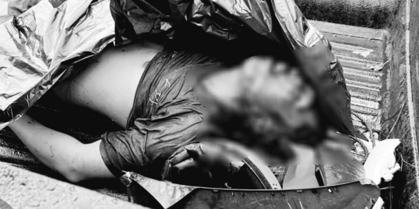 Maikel Edwar Tewas, Irvan Patah Tangan dalam Kecelakaan di Jalan Budi Utomo Ujung Timika
