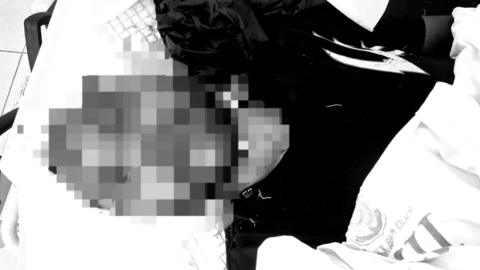 Lakalantas Tunggal di SP 5 Timika, Seorang Pria Tewas, Identitas Belum Diketahui