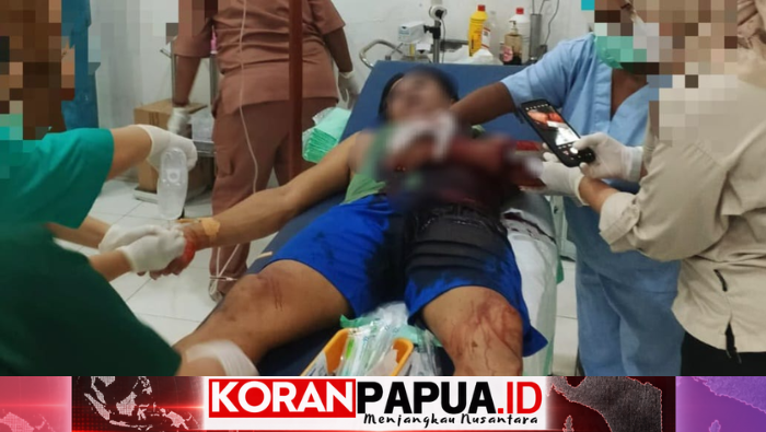Dua OTK Bacok ASN Pemkab Yahukimo di Dekai, Korban Luka di Tangan dan Punggung