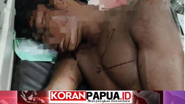 Pria Ditemukan Bersimbah Luka di Pasar Lama Timika, Kondisi Mulai Membaik